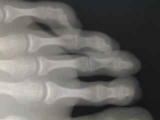 radiographie coll&egrave;ge Jules Renard 53000 Laval