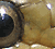 préoculaire A