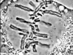 Métaphase