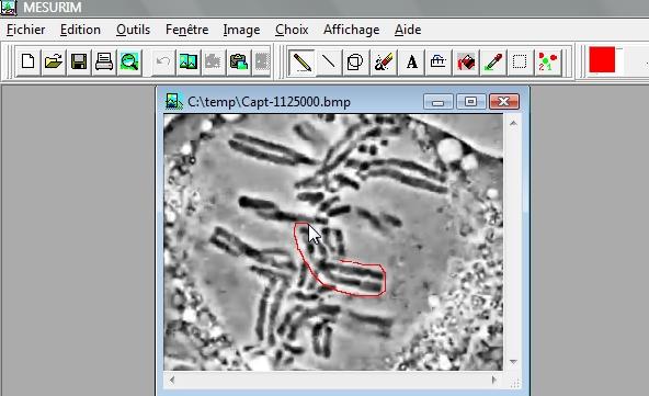 Encadrement d'un chromosome en utilisant les fonctionnalités du logiciel MesurimPro