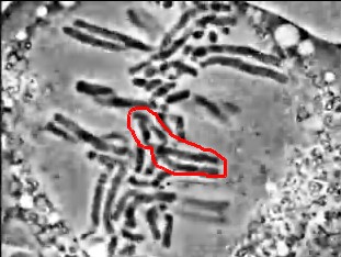 Chromosome encadré en début d'anaphase