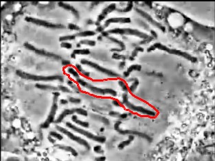 Chromosome encadré en anaphase