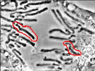 Chromosome encadré en fin d'anaphase