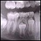 vignette : les dents sont-elles vivantes ?